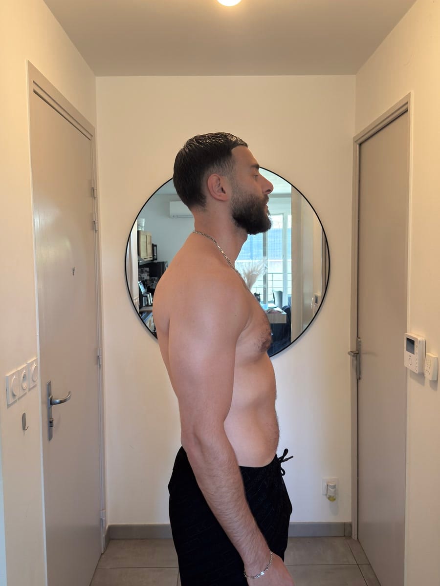 Yacine de profil, après